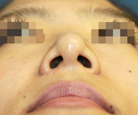 20160824po1Mあおり