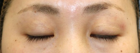 20170612po6M目元閉眼