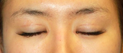 20160829po2M目もと閉瞼