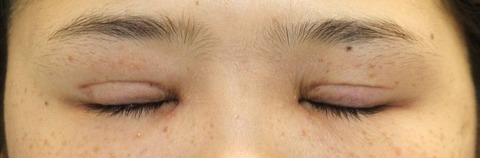 20170216po2M目元閉眼