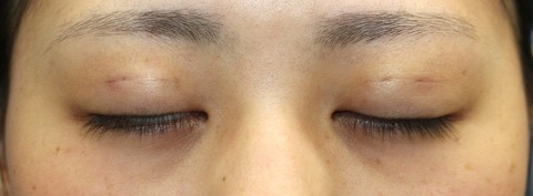 20170216po1W目元閉眼