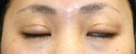 20170420po3M目元 (2)