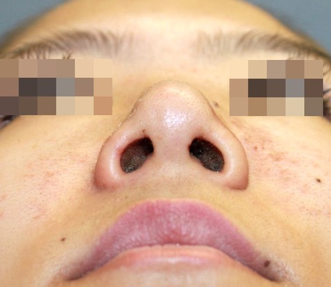 20160823po1Wあおり