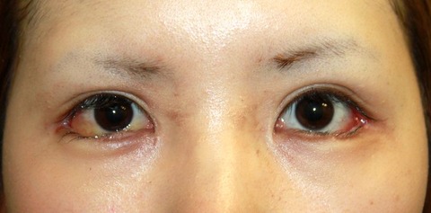 20160902po1W目もと