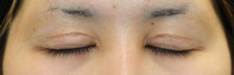 20170519po3M目元閉眼