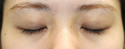 20170420po3M目元閉眼