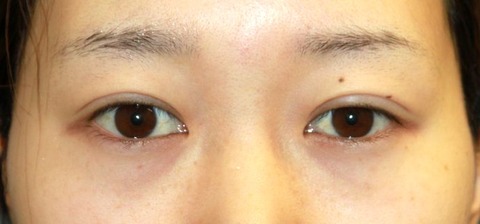 20160929po1M目もと