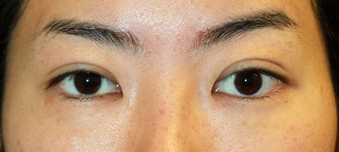 20161124po3M目もと