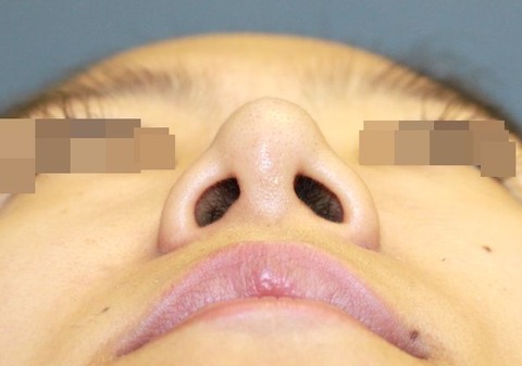 20160824po2Mあおり