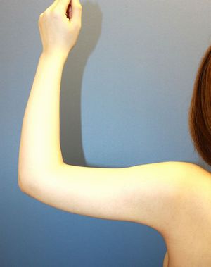 20160906po1M左腕後面