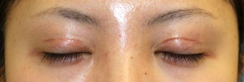 20160909po2W目元閉瞼