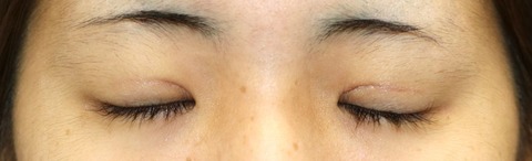 20161222po3M目元閉眼