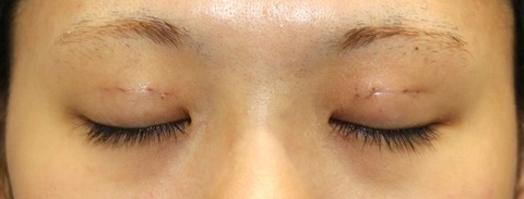 20170107po3d目元閉眼