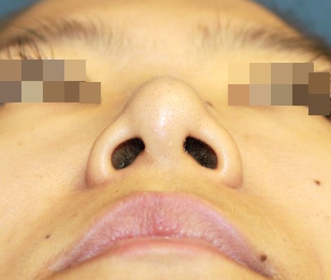 20160824po3Mあおり