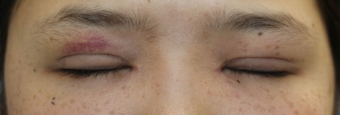 20170112po目元閉眼