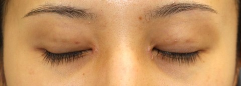 20170612po2W目元閉眼