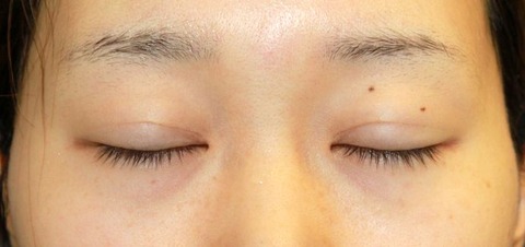 20160929po1M目もと閉瞼