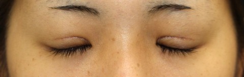 20161013po1M目元閉瞼