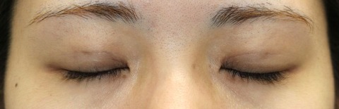 20161222po1M目元閉眼