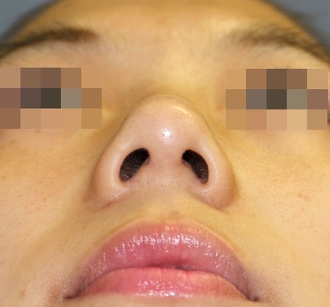 20170307po6Mあおり