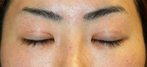 20161026po2M目もと閉瞼