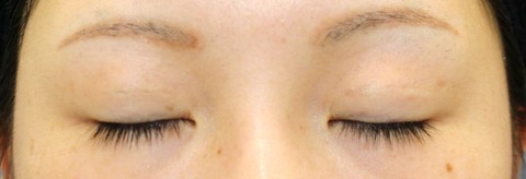 20160917po2M目元閉瞼