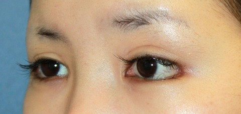 20161024po2M左斜め