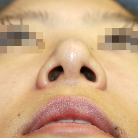 20160824po2Wあおり