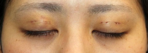 20170112po3d目元閉眼