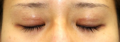 20170401po2M目元閉眼