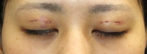 20170112po1d目元閉眼