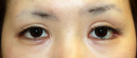 20160930po1M目もと