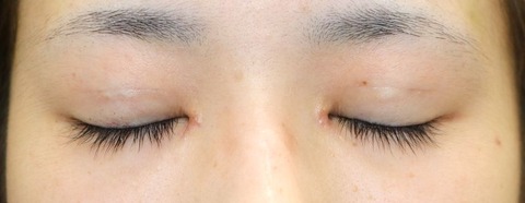 20170123po2W目元閉眼