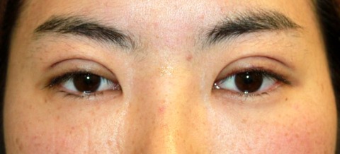 20160907po5D目もと