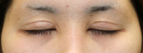 20170414po2M目元閉眼