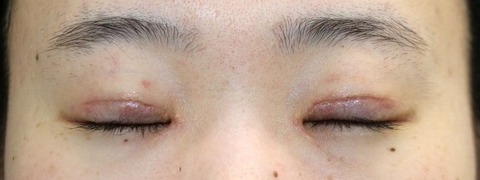 20170328po2W目元閉眼