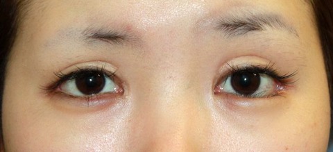 20161024po2M目もと