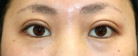 20170420po3M目元 (1)