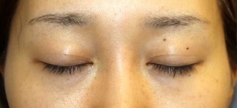 20160929po3M目もと閉瞼