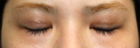 20170427po3d目元閉眼