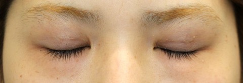 20170519po1M目元閉眼