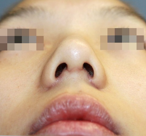 20161012po1Mあおり