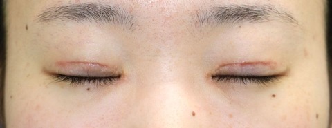 20170506po2M目元閉眼