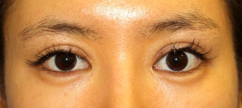 20160829po6M目もと