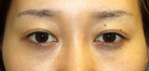 20160929po3M目もと