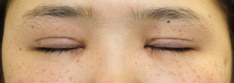 20170420tapo3M目元閉眼