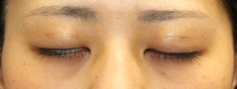 20170216po1Ｍ目元閉眼