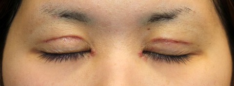 20170302po1W目元閉眼