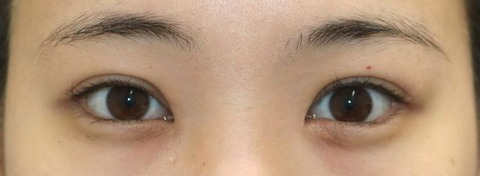 IMG_267320170506po2m