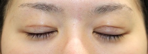 20170401po1M目元閉眼